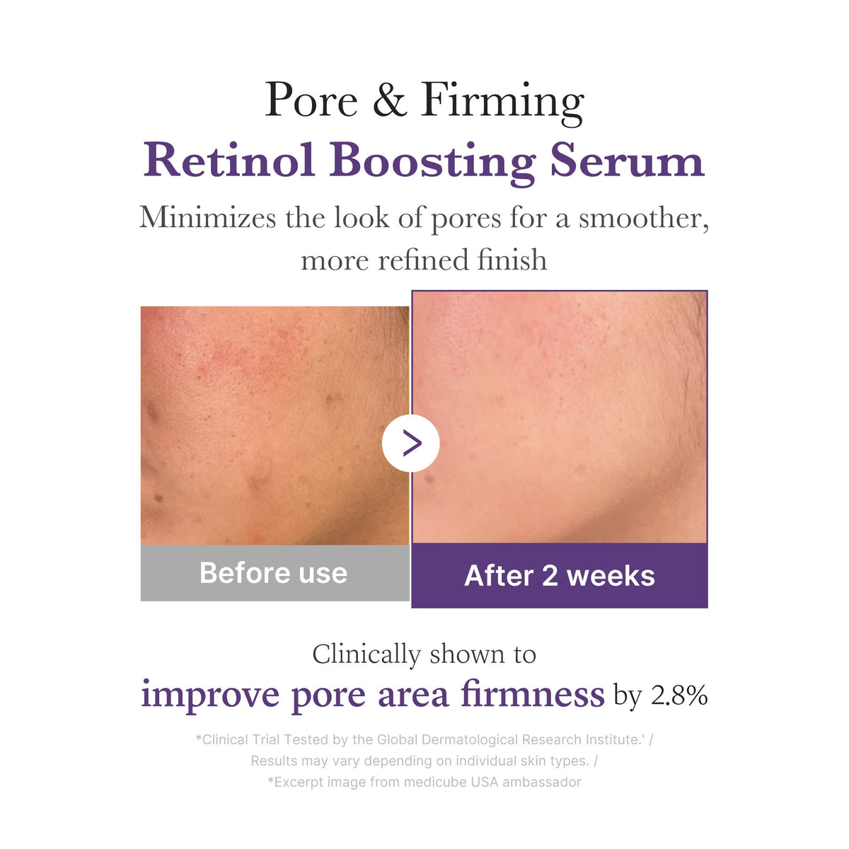 Medicube Deep Vita A Retinol Serum 30ml product image 5
