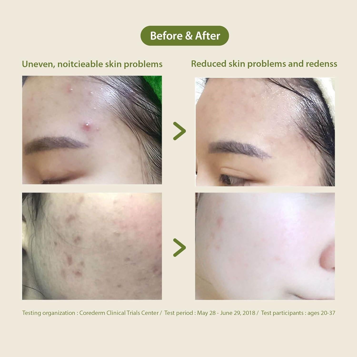 Blithe Patting Splash Mask Soothing & Healing Green Tea 150ml product image 8