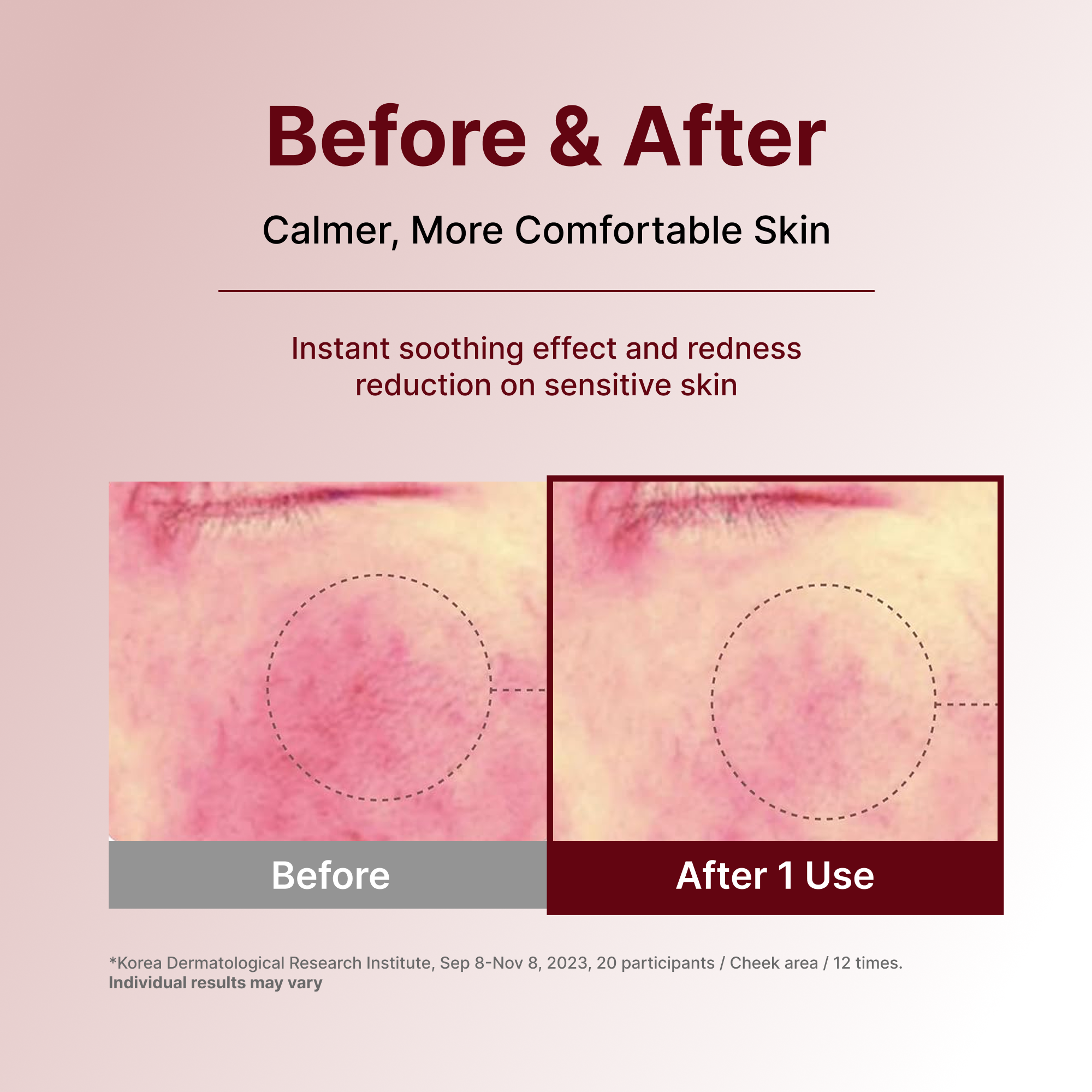 Centellian24 Expert Madeca Cream Signature 50ml — product detail image 6