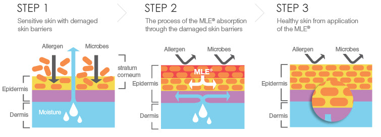 ATOPALM MLE Lotion 120ml - product image 4