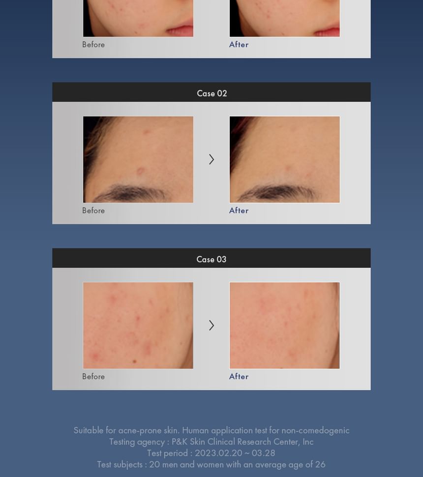 Dr.Ceuracle AC Cure Solution Blue One 50ml — Dr.Ceuracle product image 6