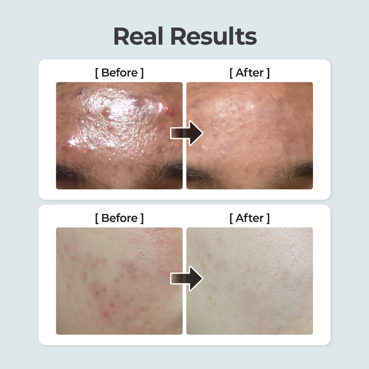 Numbuzin No. 1 Pure-Full Calming Herb Toner 300ml — official product image 6