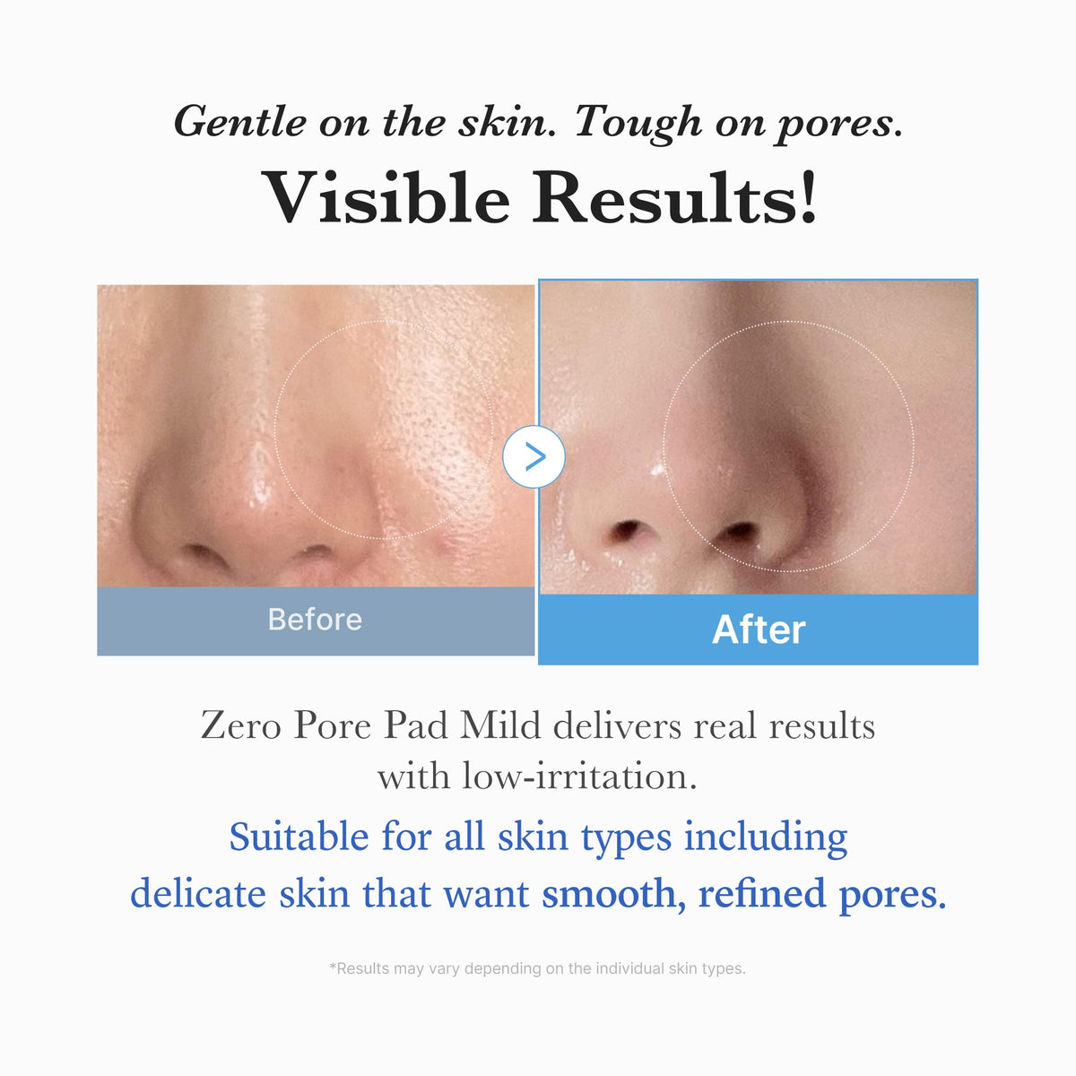 Medicube 2024 Zero Pore Pad Mild 70pcs product image 4