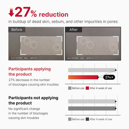Medicube Red Acne Body Peeling Shot 110ml product image 4