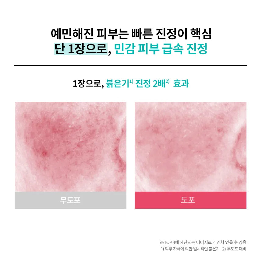 Aestura A-Cica 365 Soothing Repair Mask Sheet pH4.5 5ea - official AESTURA product image 8
