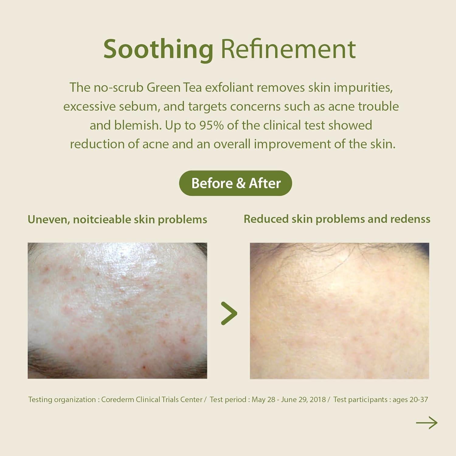 Blithe Patting Splash Mask Soothing &amp; Healing Green Tea 150ml product image 7
