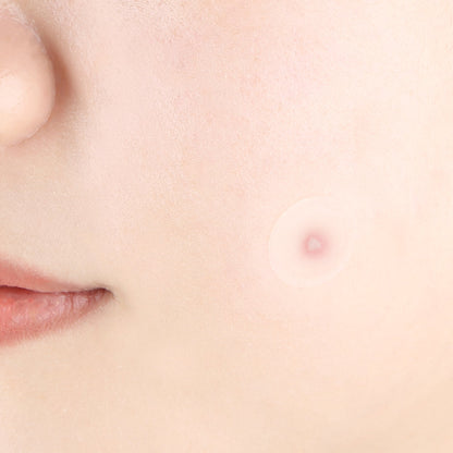 Pyunkang Yul Clear Spot Patch 72ea official product gallery image 3