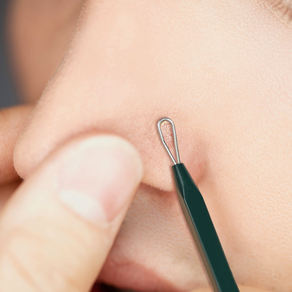 Pyunkang Yul Pimple Extractor official product gallery image 3