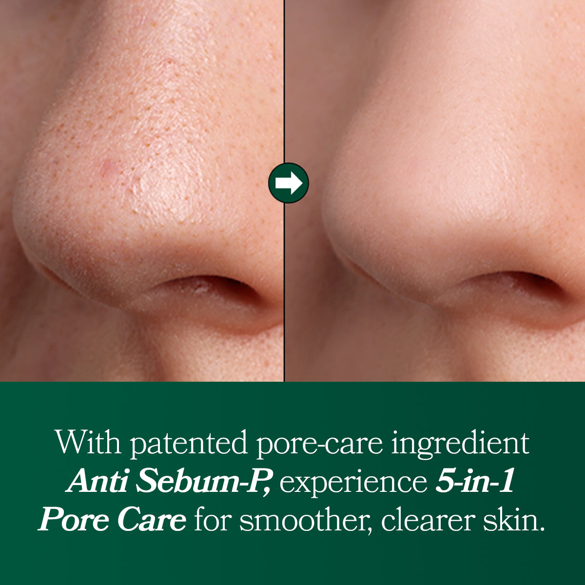 Omitted Fresh Lime Glow &amp; Pore Refining Serum 50ml