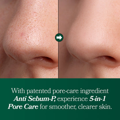 Omitted Fresh Lime Glow &amp; Pore Refining Serum 50ml