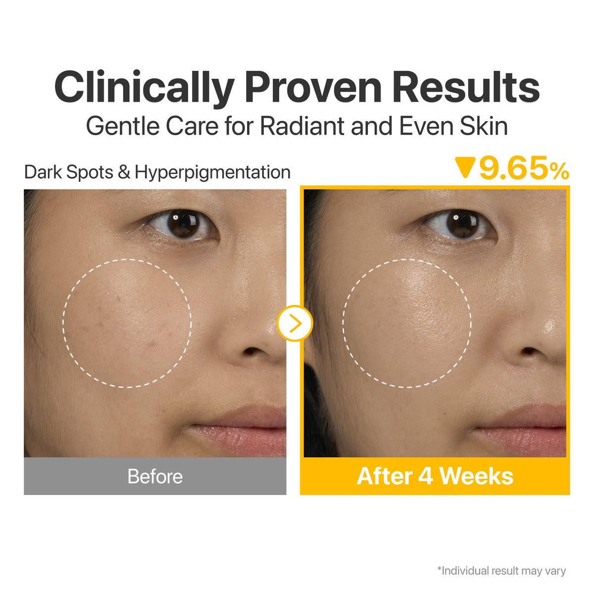 Numbuzin No. 5 Vitamin Concentrated Serum 30ml — official product image 7