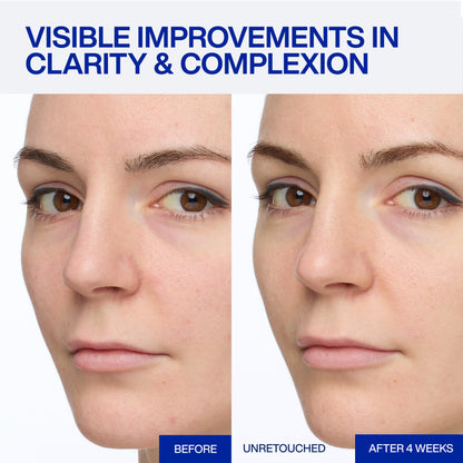 IOPE Vitamin C Expert 25% Antioxidant Toning serum 23ml — Face Serums product image 110