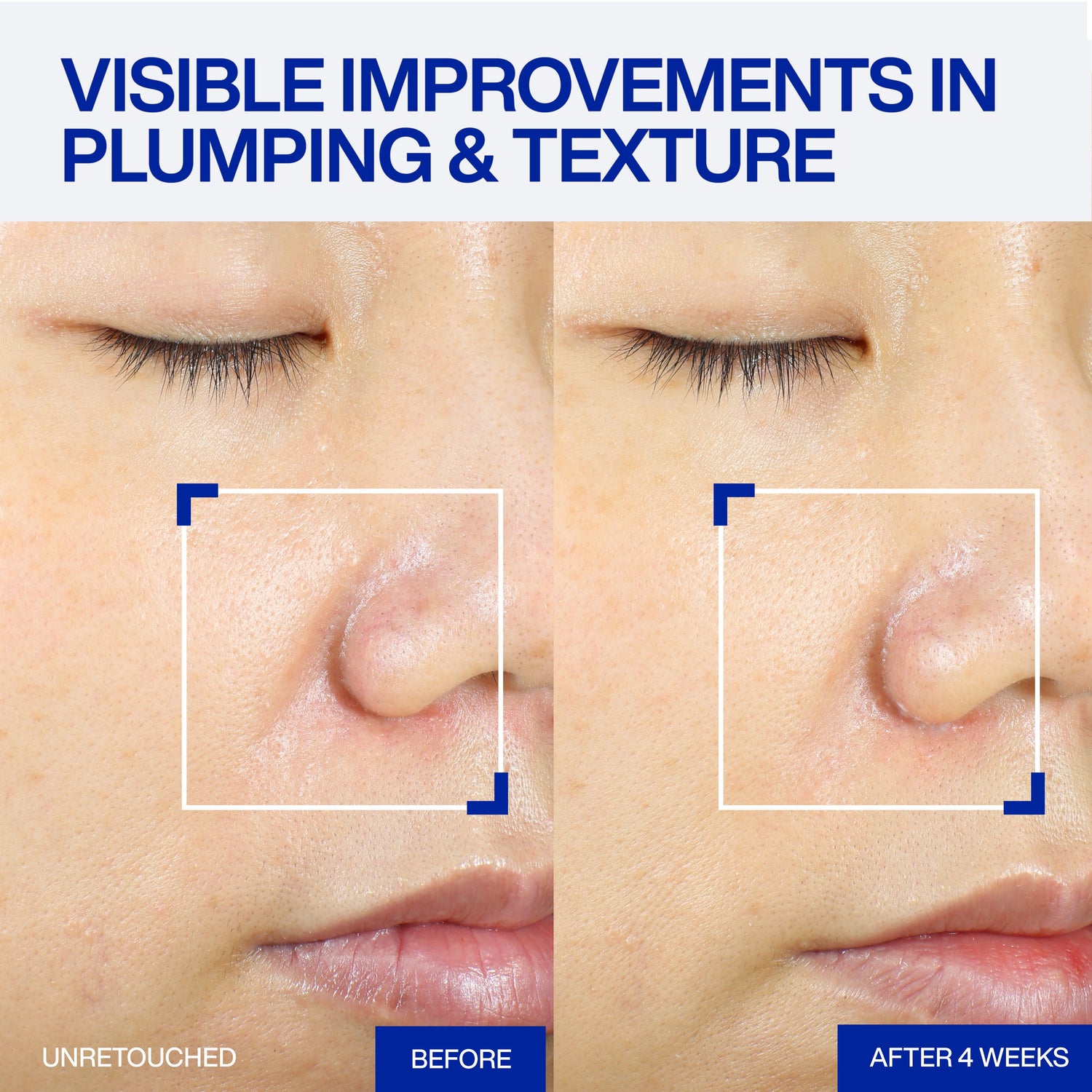 IOPE XMD STEMⅢ CLINICAL RECOVER SERUM 50ml — Face Serums product image 31