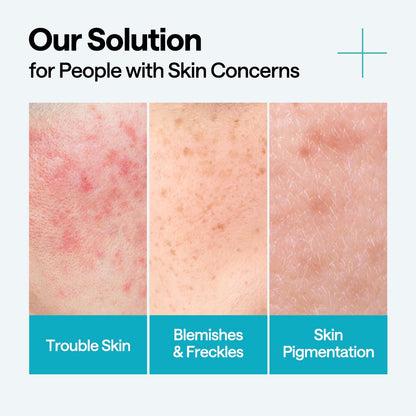 Mediheal Madecassoside Blemish Repair Serum 40ml product image 5