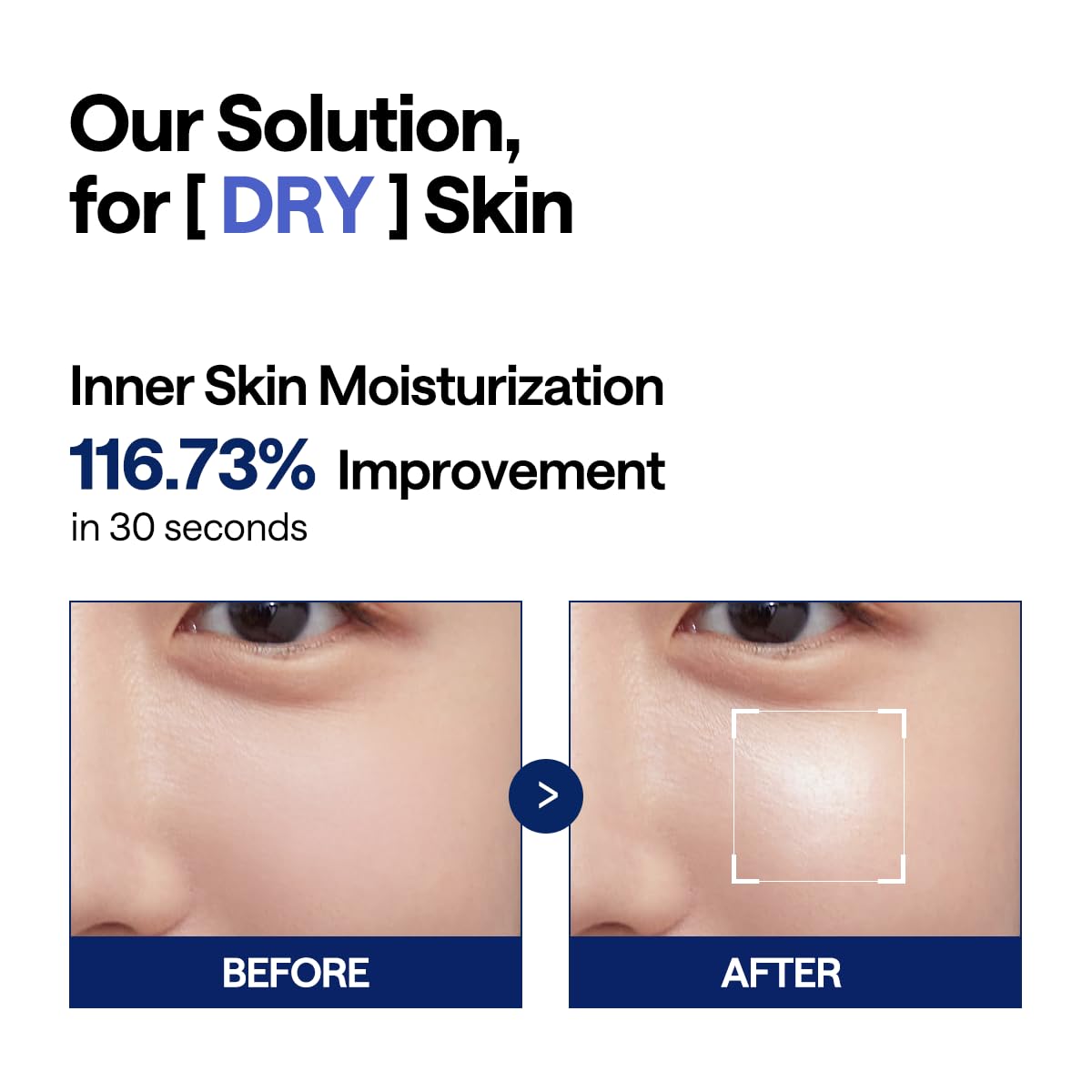 Mediheal Watermide Moisture Pad 100ea product image 4
