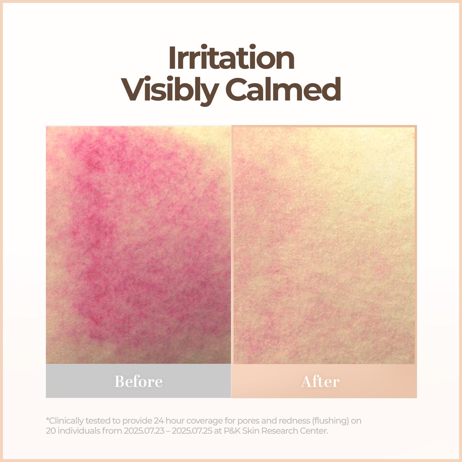 CellFusionC Skin Blemish Balm Intensive (Signature Beige) - 30ml — product detail image 9