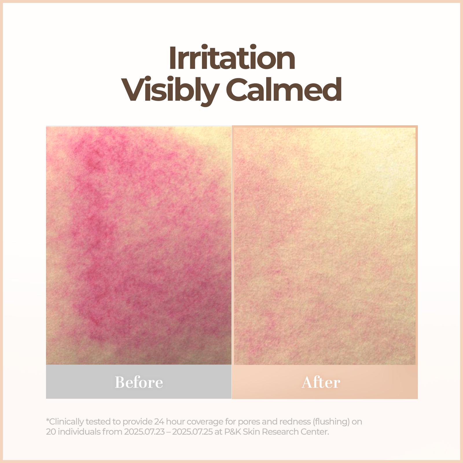 CellFusionC Skin Blemish Balm Intensive (Signature Beige) - 30ml — product detail image 9