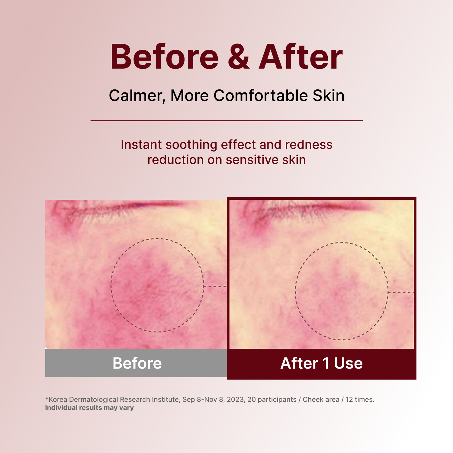 Centellian24 Expert Madeca Cream Signature 50ml — product detail image 6
