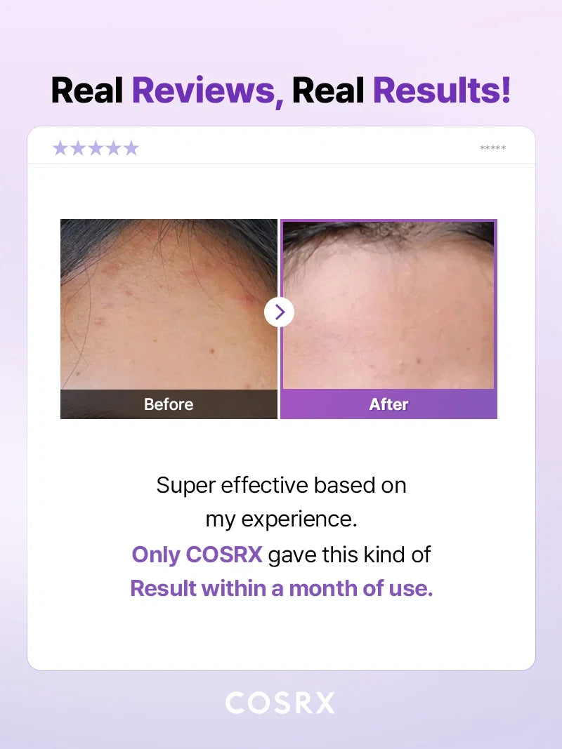COSRX AHA/BHA Clarifying Treatment Toner 150ml — product detail image 5