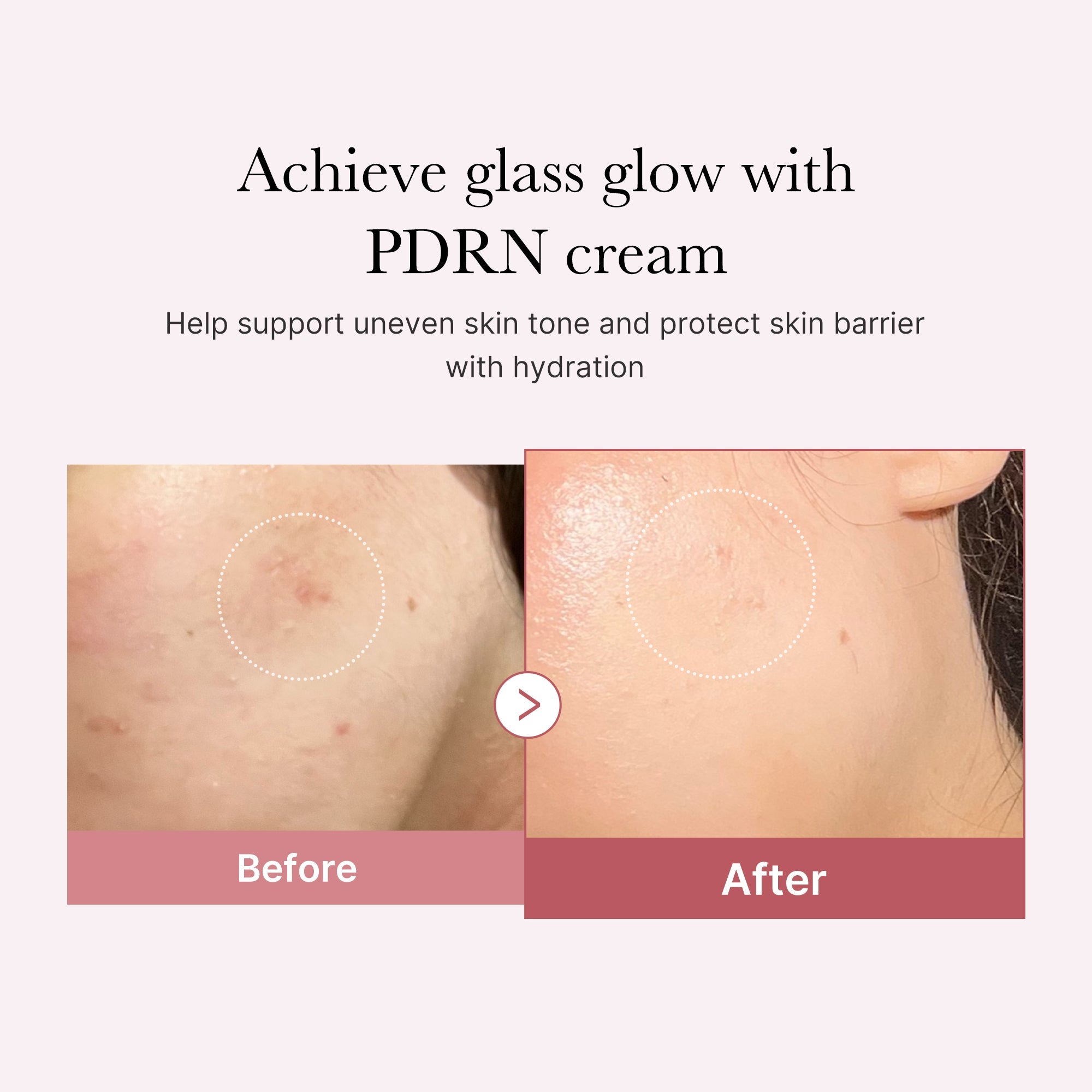 Medicube PDRN Pink hyaluronic moisturizing Cream 50ml product image 4