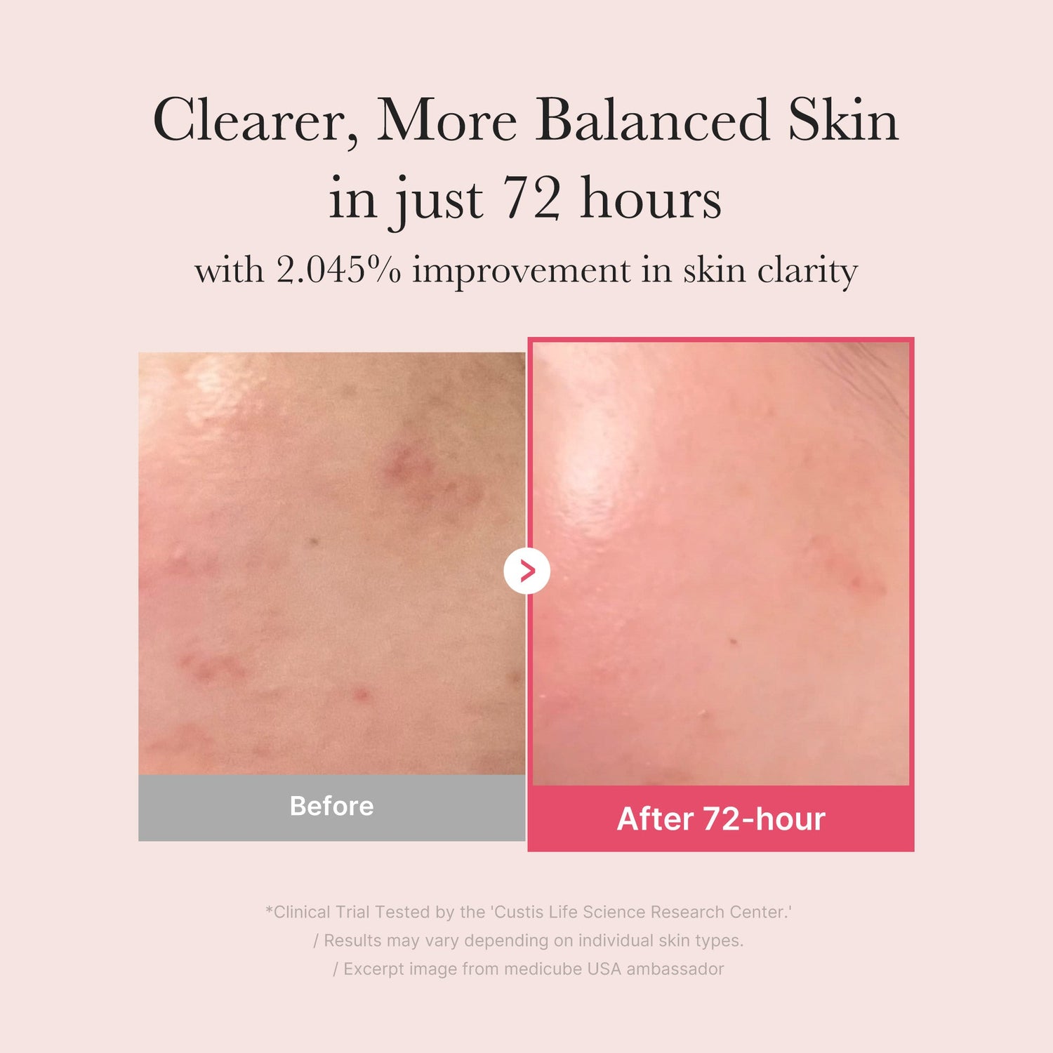 Medicube TXA Niacinamide Serum 30ml product image 4