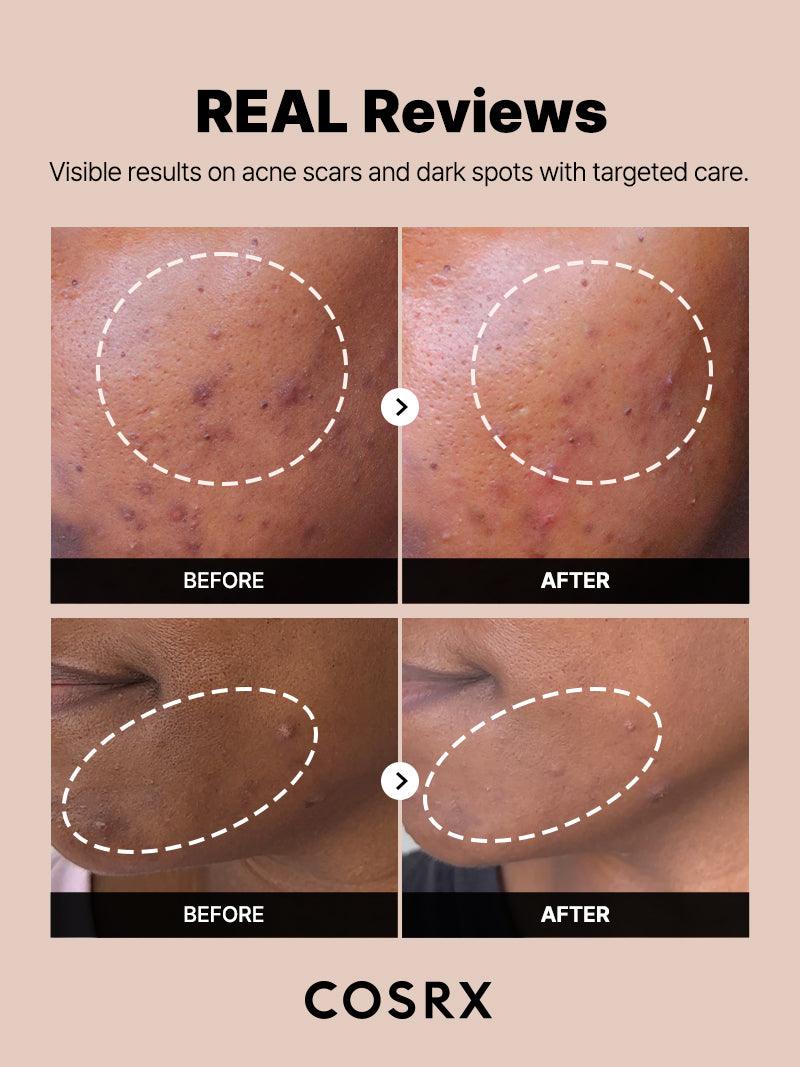 COSRX The Alpha-Arbutin 2 Discoloration Care Serum 50ml — product detail image 5