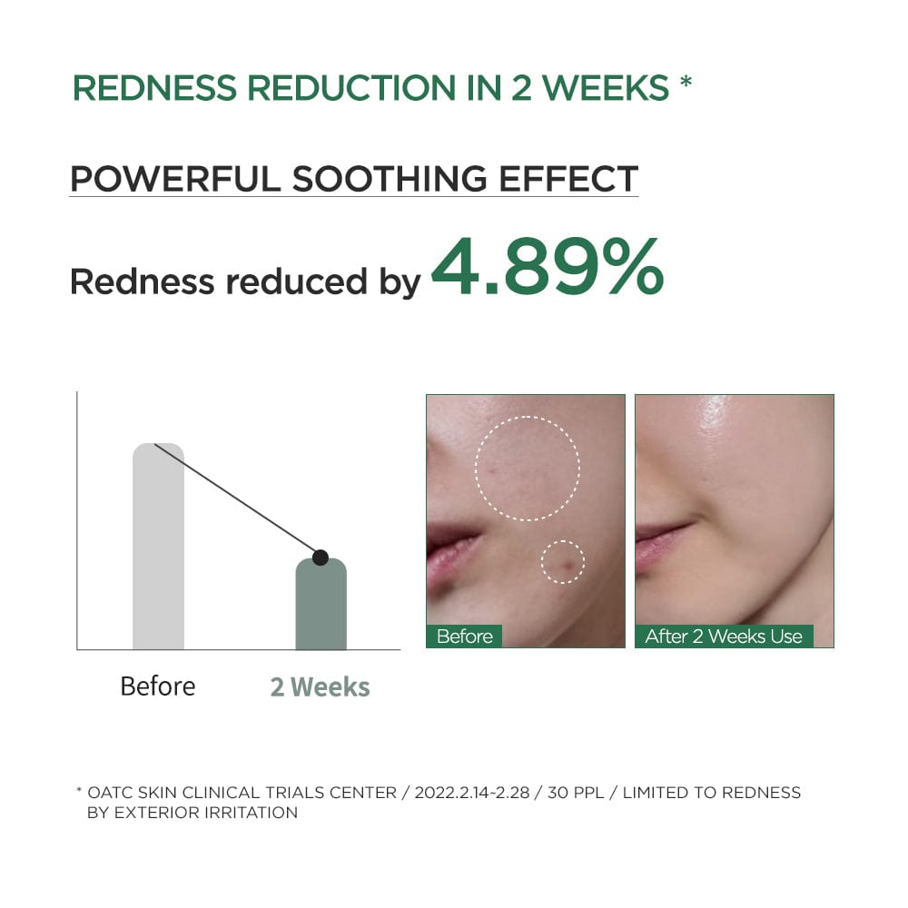 Anua HEARTLEAF 80% MOISTURE SOOTHING AMPOULE 30ml - official ANUA product image 4