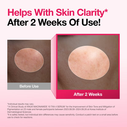 Anua NIACINAMIDE 10% + TXA 4% DARK SPOT CORRECTING SERUM 30ml - official ANUA product image 3