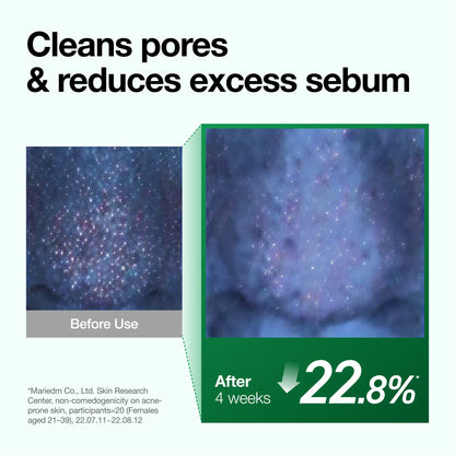 Anua HEARTLEAF PORE CONTROL CLEANSING OIL 200ml - official ANUA product image 5
