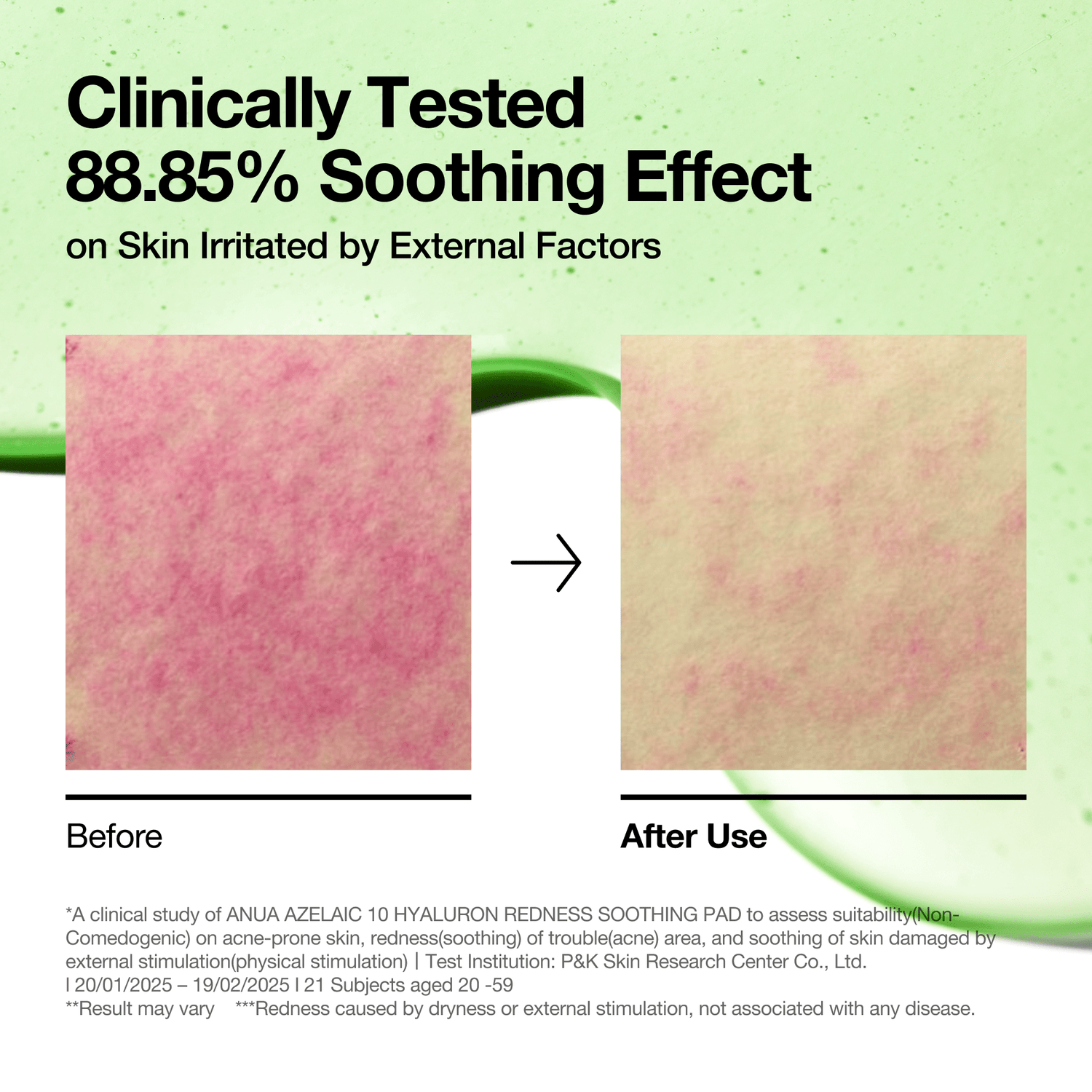 Anua Azelaic 10 Hyaluron Redness Soothing Pad 230ml 90ea - official ANUA product image 3