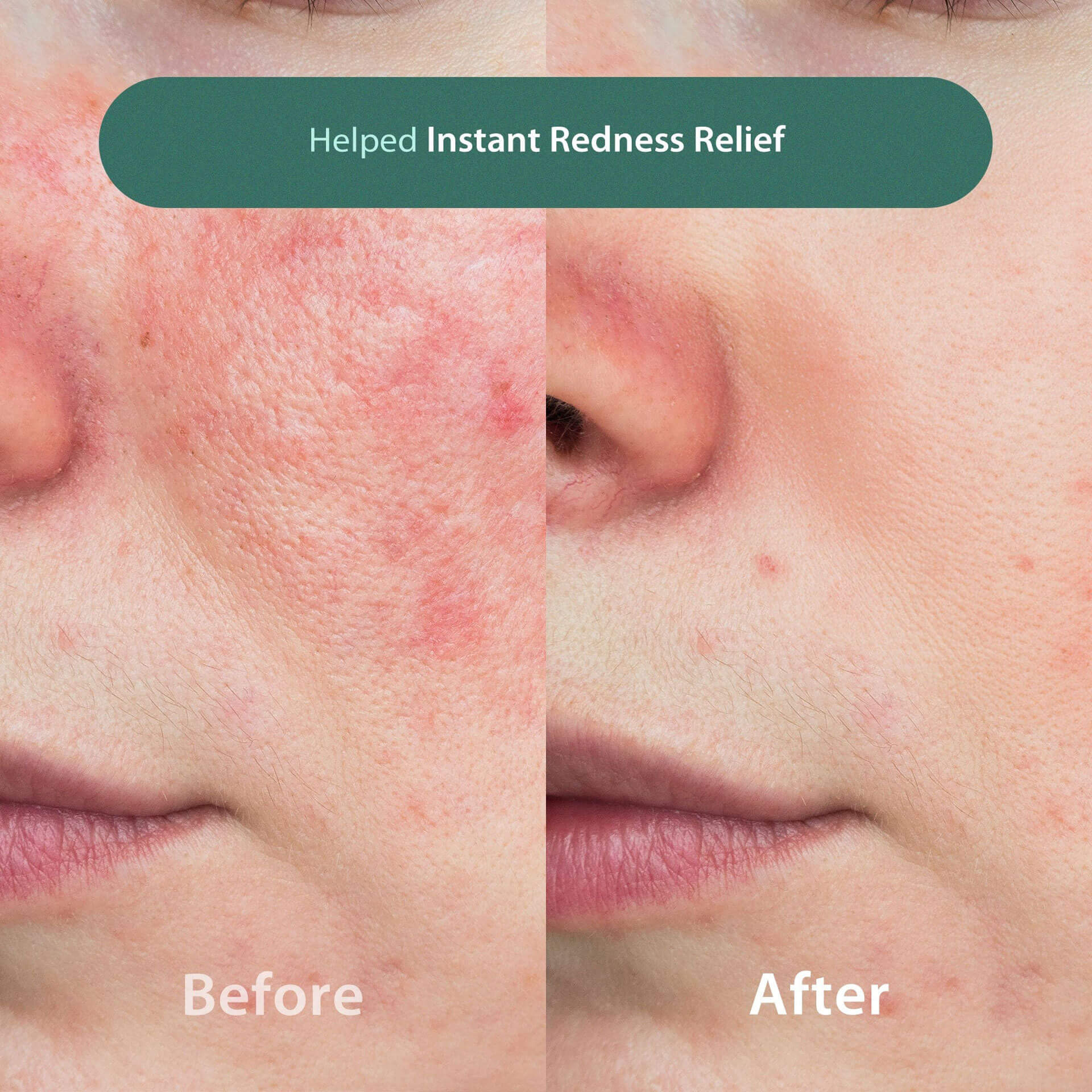 Blithe Vital Treatment 6 Calming Leaves 150ml product detail image 6