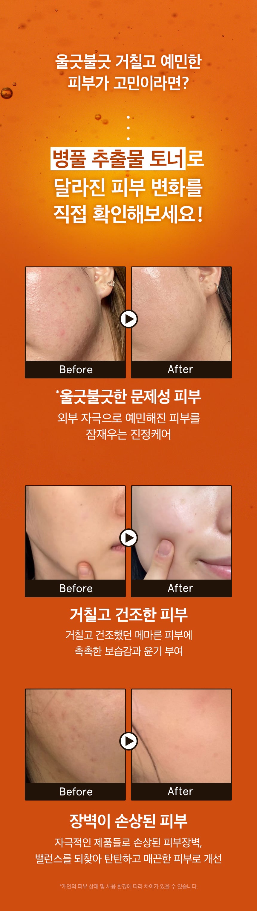One Thing Centella Asiatica Extract 150ml Toner — ingredients, texture, or how-to-use image