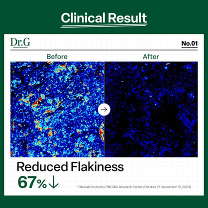 Dr.G Red Blemish Clear Soothing Toner 300ml product image detail 5