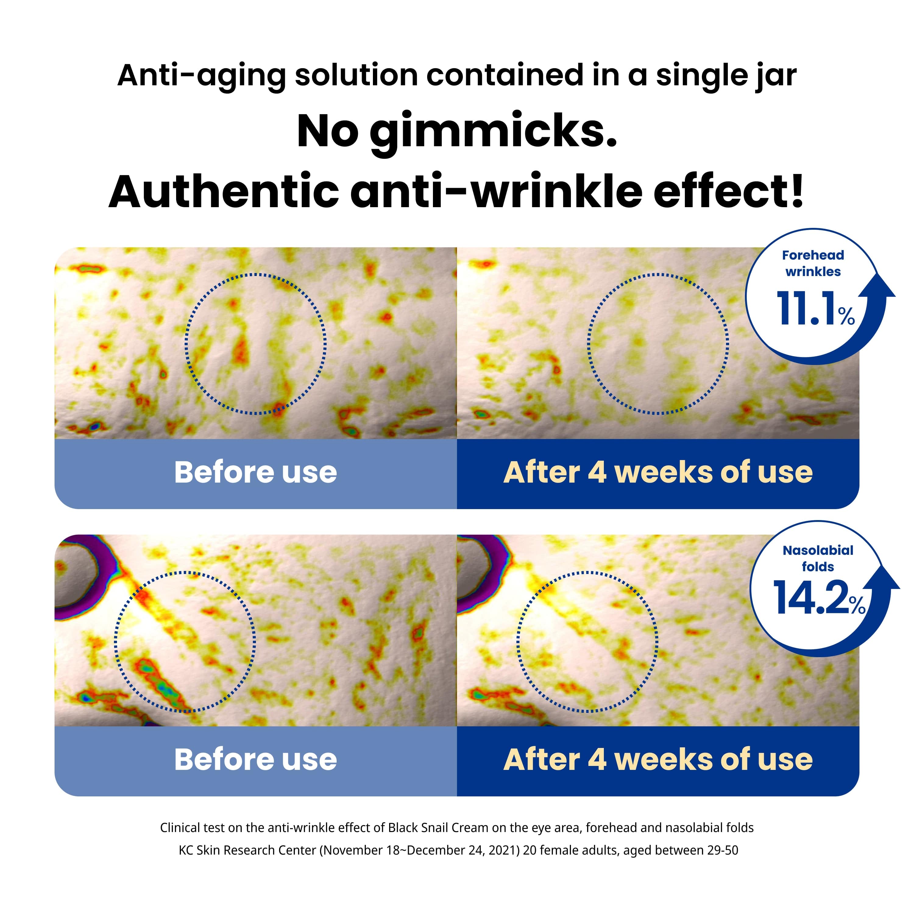 Dr.G Black Snail Cream 50ml product image detail 7