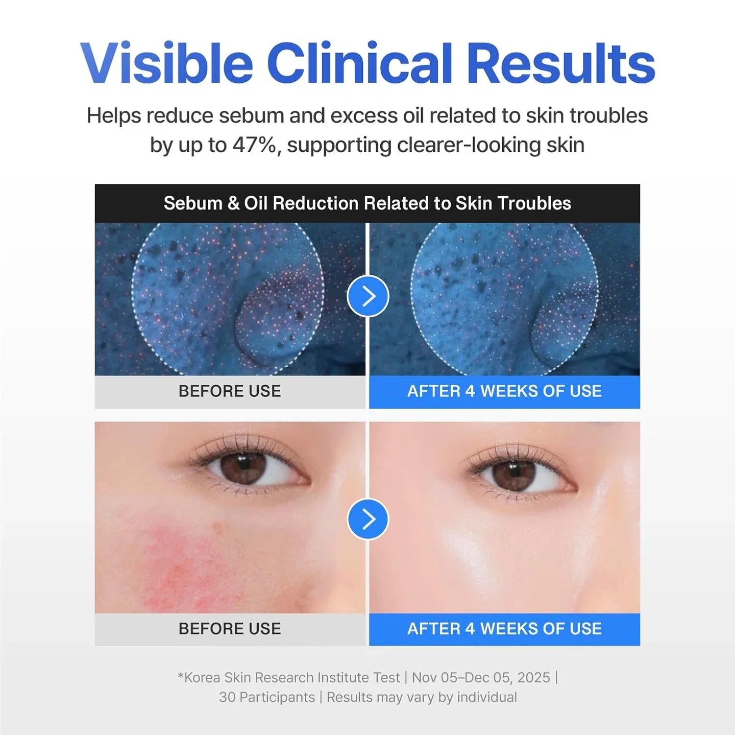 Centellian24 Madeca Hydra Solution Gel Cream 50ml — product detail image 3