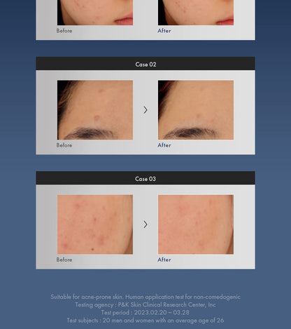 Dr.Ceuracle AC Cure Solution Blue One 50ml — Dr.Ceuracle product image 6