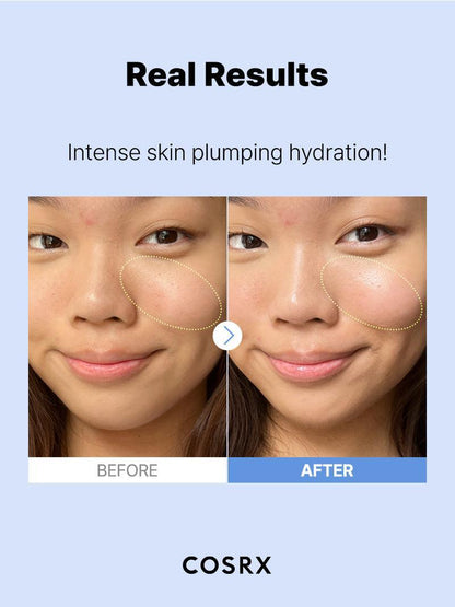 COSRX The Hyaluronic Acid 3 Serum 20ml — product detail image 7