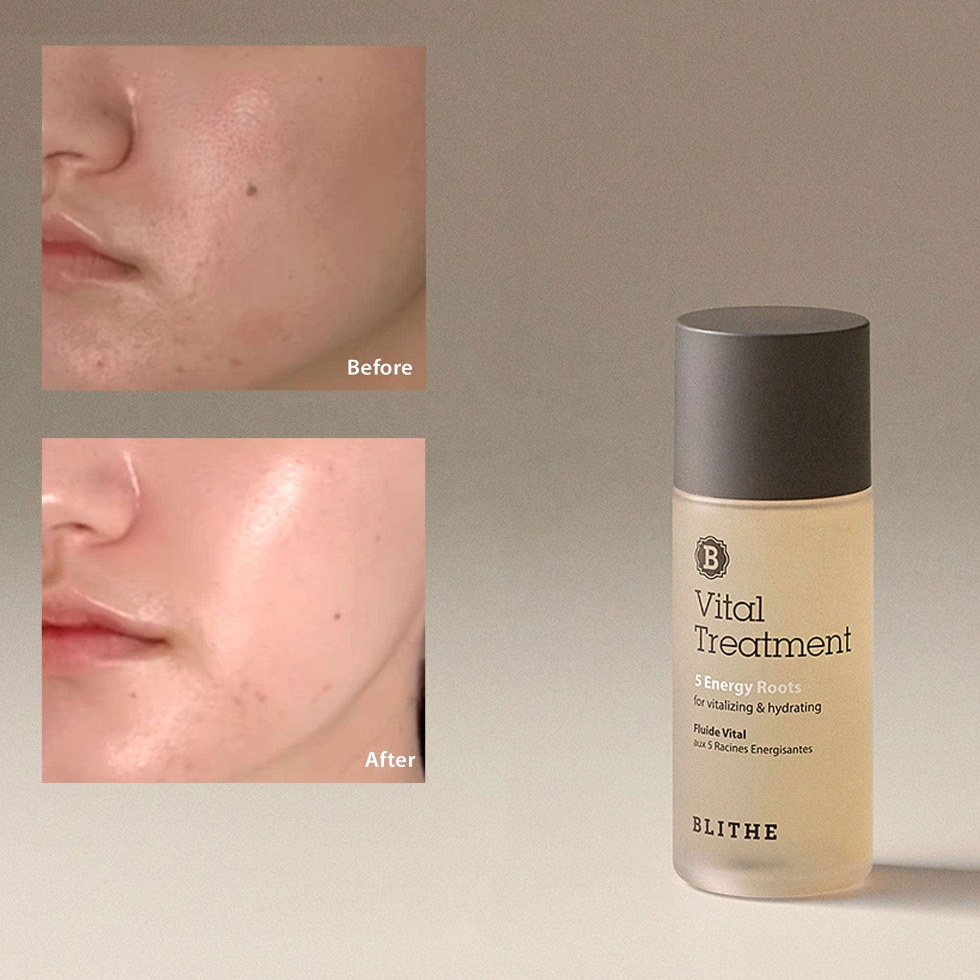 Blithe Vital Treatment 5 Energy Roots 150ml product detail image 8