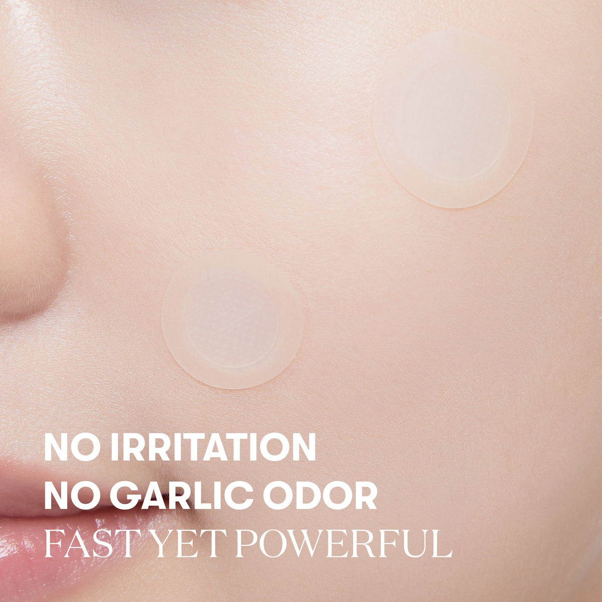 VT Cosmetics Garlic AC Reedle Shot Point Patch - official product image 6