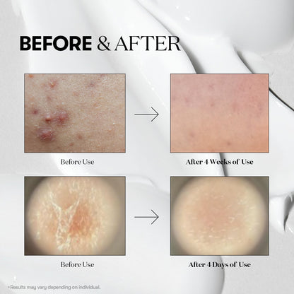 VT Cosmetics Reedle Shot 100 50mL - official product image 5
