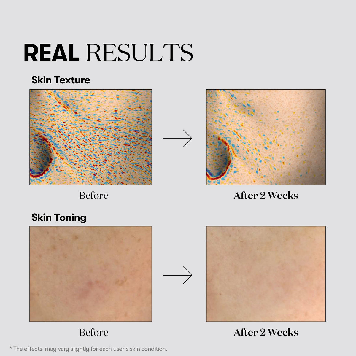 VT Cosmetics TX-Toning Essence 2000 Shot 30ml - official product image 6