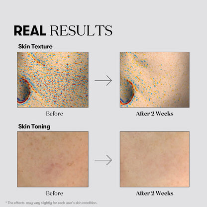 VT Cosmetics TX-Toning Essence 2000 Shot 30ml - official product image 6